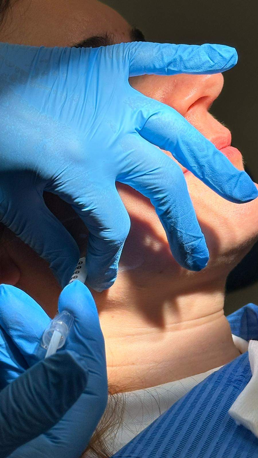 Tratamiento del bruxismo en Esplugues de Llobregat